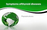 symptoms of thyroid diseases