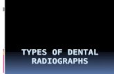 Types of dental radiographs in children