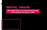 Post-Processing of Prostate Perfusion MRI