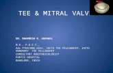 Mitral valve tee2013(dr dharmesh)