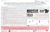 Epileptogenic Lesion Quantification in MRI Using Contralateral 3D Texture Comparisons