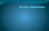 Acute Abdomen acute appendicitis