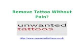 Remove Tattoo Without Pain