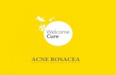 Acne Rosacea- The Disease, Its Complications And Homeopathic Treatment