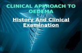 History & examination of edema