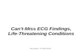 QUANG - Can't-Miss ECG Findings, Life-Threatening Conditions