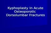 Kyphoplasty mahgoub presentation