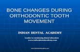 Bone changes during ortho. tooth movement dr.anusha /certified fixed orthodontic courses by Indian dental academy