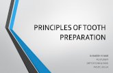 Principles of tooth preparation