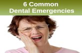 6 common dental emergencies