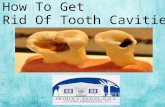 How to get rid of tooth cavities