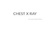 Chest x-rays for 6th year students