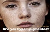 What kind of pigmentation are you?