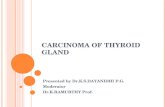 Carcinoma of-thyroid-gland2003-1233910943260832-2