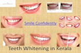 Teeth whitening in kerala