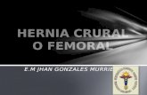 Hernia crural o femoral