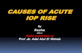 Acute Rise in IOP (Dr. Rasha, senior resident of ophthalmology)