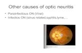 Optic nerve 1