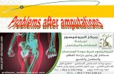 مشاكل البتر- Problems with Amputation - البروفيسور فريح ابوحسان - استشاري جراحة العظام والمفاصل في الاردن