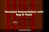 Neonatal resuscitation with bag & mask