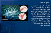 Stroke: Early detection and prevention