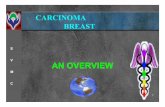 Carcinoma of breast- the second most common killer in women