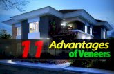 11 advantages of veneers