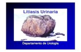 Litiasis Urinaria 1