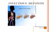 infectious hepatitis