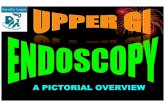 Upper GI Endoscopy - A pictorial overview