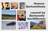 Human Bartonellosis