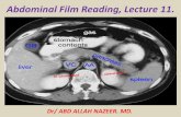 Presentation1.pptx, abdominal film reading, lecture 11.