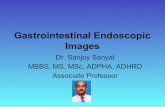 Gastrointestinal Endoscopic Images - Sanjoy Sanyal