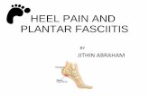 Heel Pain and Plantar Fasciitis