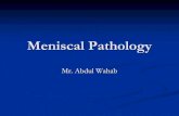 Meniscal pathology