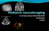 Pediatric neuroimaging