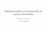 Normal awake and sleep EEG