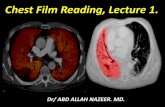Presentation1.pptx, chest film reading. lecture 1