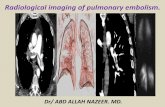 Presentation1.pptx, radiological imaging of pulmonary embolism.