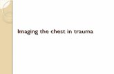 Imaging in chest trauma