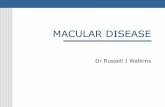 MACULAR DISEASE