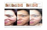 Jeunesse before and after photos