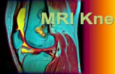 Mri knee 3