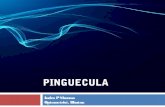 Pinguecula - An overview