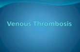 Venous thrombosis