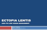 Ectopia lentis and its low vision management