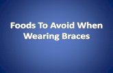 Foods To Avoid When Wearing Braces