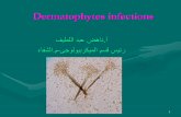 dermatophytes infections