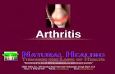 Arthritis 7 apr-2012