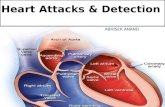 Heart attacks & detection